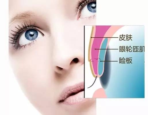 郑爽泪沟、眼袋明显到糊住镜头，学生*党**们的通病该怎么治？