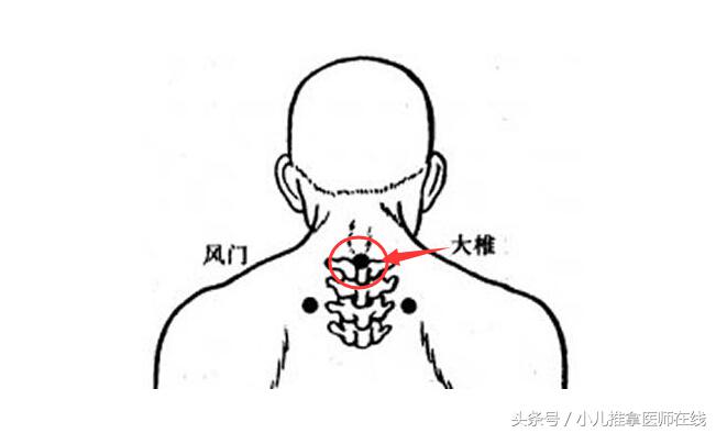三伏贴都贴哪些穴位,三伏贴适合贴什么穴位呢