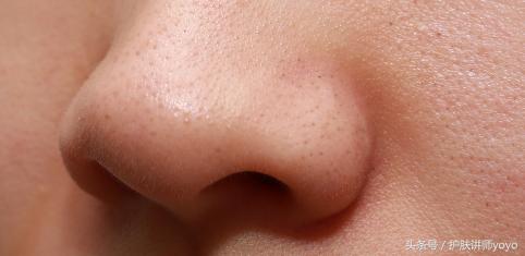 皮肤的皮脂膜受损怎么修复,皮脂膜受损皮肤干