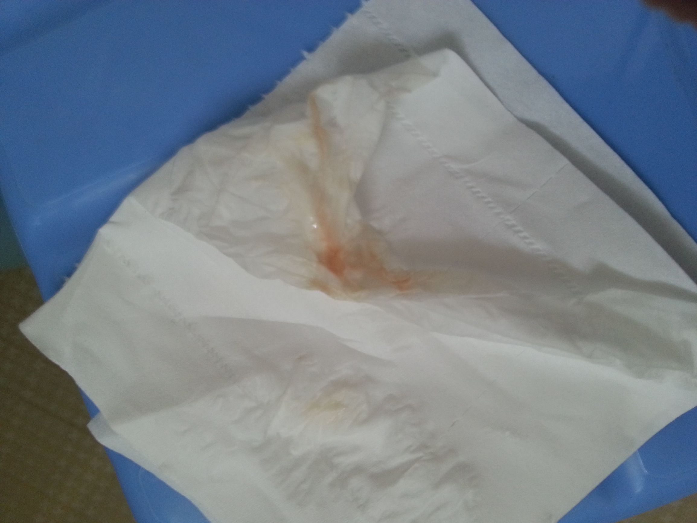 辟谣：孕妇见红就要生？全面解说“见红”和“出血”的区别！