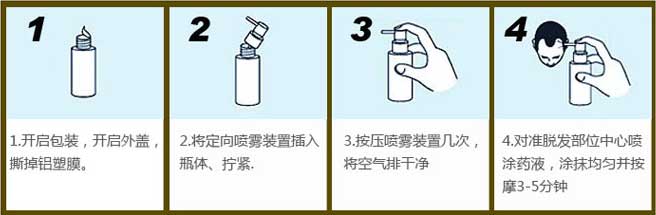 毛囊检测可以查出脱发原因吗,毛囊检测都是正常脱发还有救吗