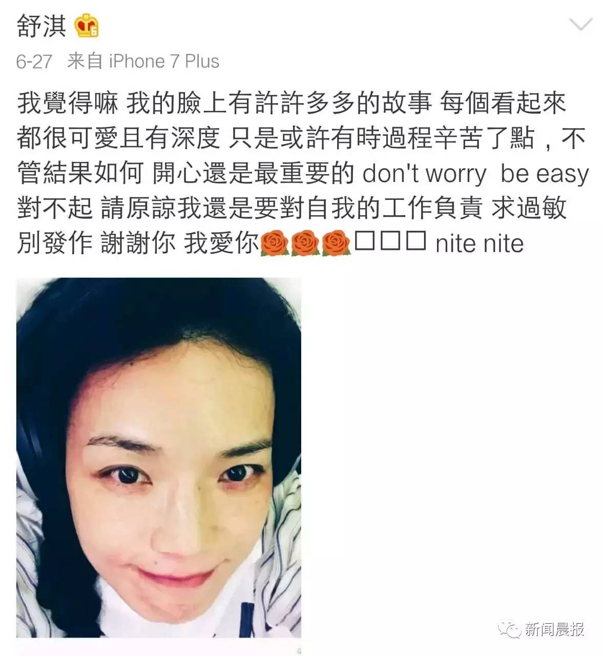 明星都逃不掉的事,健康Q博士说不定有办法