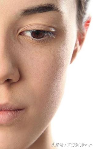 皮肤的皮脂膜受损怎么修复,皮脂膜受损皮肤干