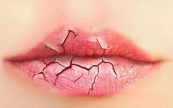 夏天嘴唇干燥是怎么回事,口干舌燥嘴唇脱皮喝水也不管用