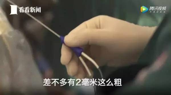 捐卵,被明码标价的青春|关于捐卵应该知道的科普