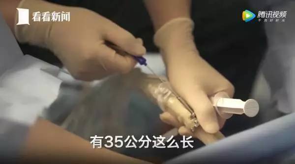 捐卵,被明码标价的青春|关于捐卵应该知道的科普