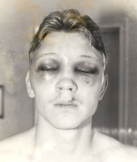 赛场作弊,拳套里塞东西作弊的拳王