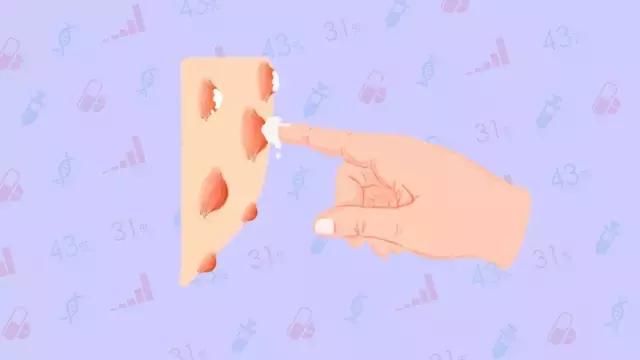 协和去黑头调理液,协和医生推荐祛痘痘