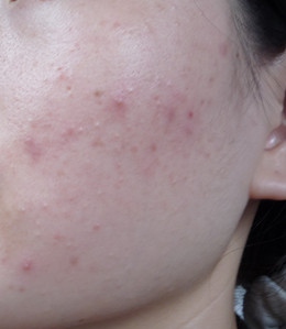 底妆教程持久不卡粉不脱妆遮瑕,遮瑕底妆教程持久不卡粉不脱妆