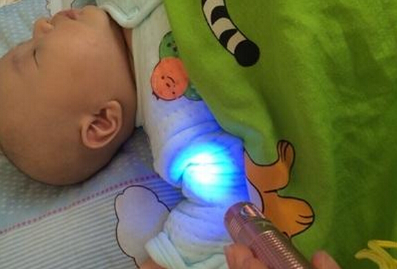 儿童穿荧光的衣服危害,宝宝的衣服有荧光剂有什么影响