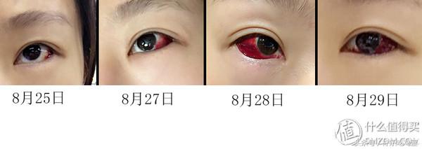 早产宝宝是不是适应环境的能力强,早产宝宝增加抵抗力