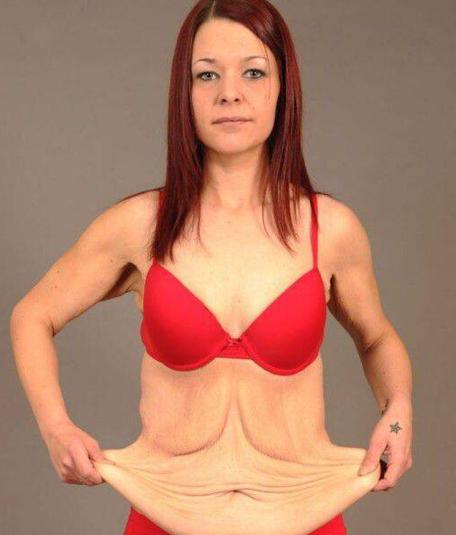 减肥期间怎样能不让脸部皮肤松弛,大基数减肥皮肤松垮能恢复吗