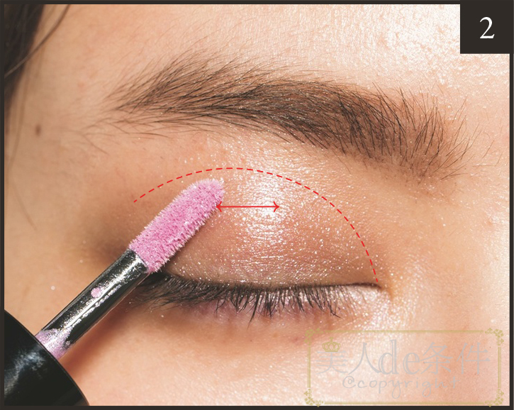 眉头太低打玻尿酸怎么能提上去,经常皱眉要不要打玻尿酸