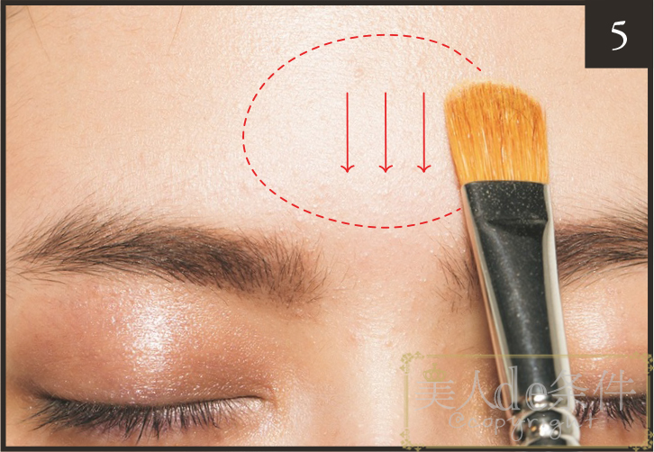 眉头太低打玻尿酸怎么能提上去,经常皱眉要不要打玻尿酸