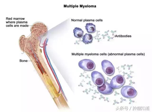 喝咖啡能防肝硬化？吓得我又多喝了一口！