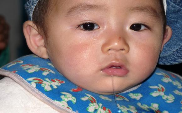 宝宝长牙痛吗,3岁半宝宝智齿位置长牙疼痛