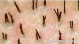 头发少适合什么发型,头发少怎么扎好看