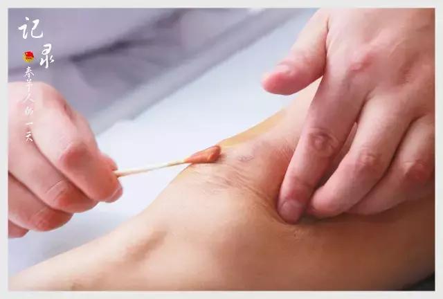 一年300台手术，解密奉节骨科医生的一天！这才是他们最真实的生活