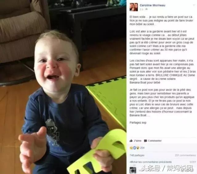 宝宝防晒霜使用不当会造成灼烧?烧烤模式般的天气下,宝宝防晒怎么选,防晒霜怎么用?