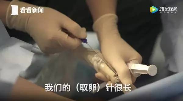 捐卵,被明码标价的青春|关于捐卵应该知道的科普