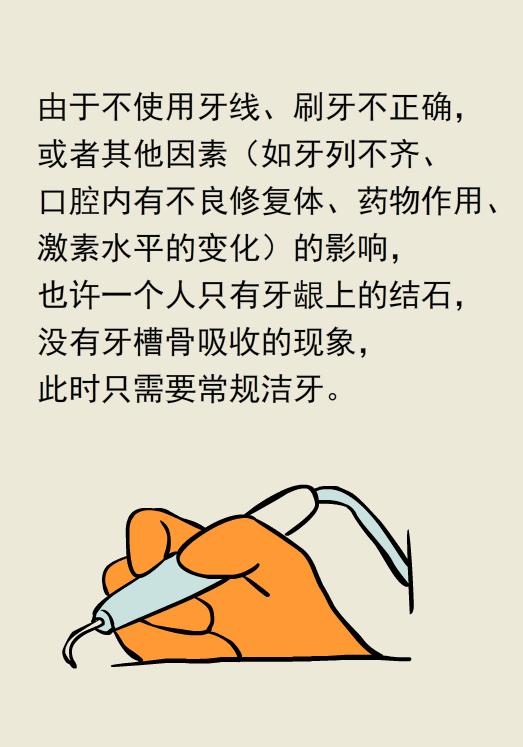 为什么洗牙以后还要做牙周刮治,为什么洗牙后还要刮治