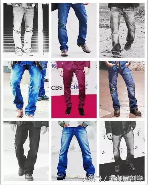 什么是o型腿,绑腿可以矫正o型腿吗