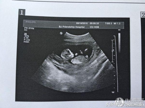 早产宝宝是不是适应环境的能力强,早产宝宝增加抵抗力