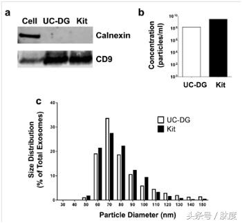 如何测定提取出的外泌体浓度,外泌体纯化