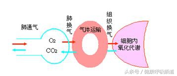 肺心病二氧化碳高如何排出,肺心病人二氧化碳潴留怎么办