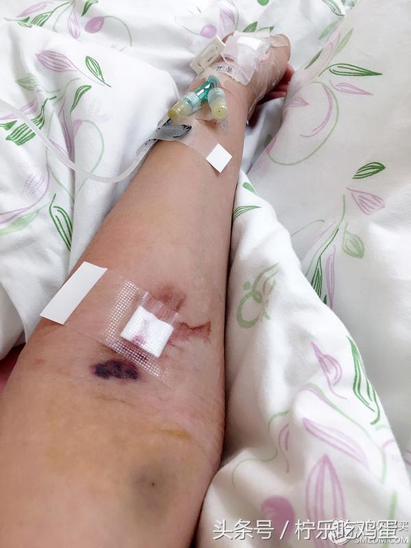 早产宝宝是不是适应环境的能力强,早产宝宝增加抵抗力