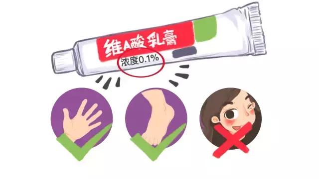 协和去黑头调理液,协和医生推荐祛痘痘