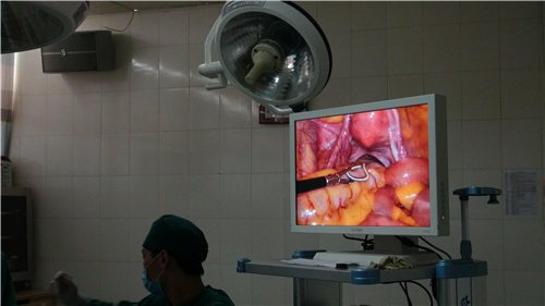 节育环还会过敏长到肉里面?到底该不该上环,看了以后真心疼女人!