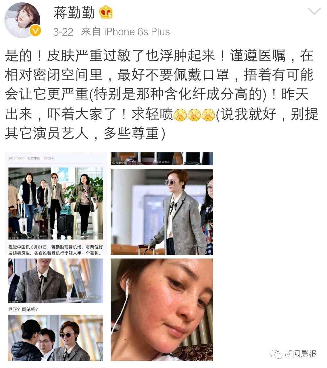 明星都逃不掉的事,健康Q博士说不定有办法