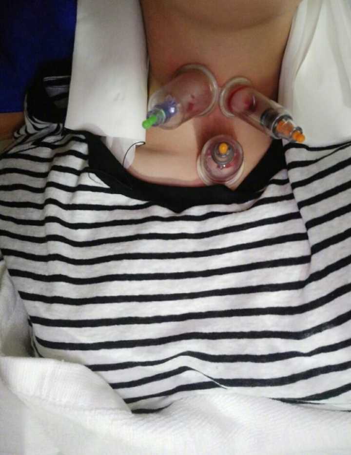 大幂幂干活不要命,生病以至要接受放血治疗,但又被媒体黑是什么梗,网友直逼媒体道歉