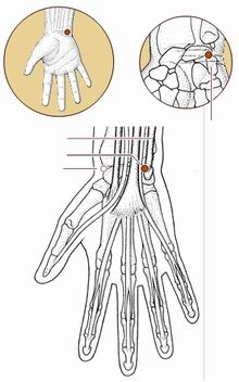 心烦失眠针灸,心烦针灸哪个穴位