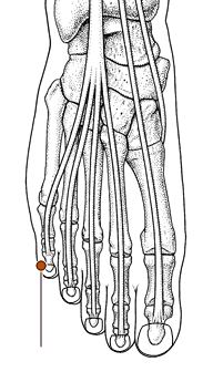心烦失眠针灸,心烦针灸哪个穴位