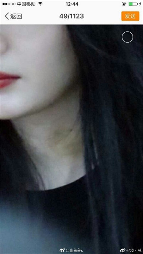 杨幂脖子前后对比,杨幂吻痕