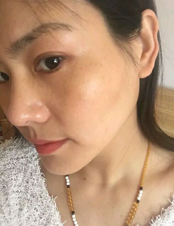 扑尔敏能改善大红脸吗,脸过敏吃扑尔敏多久有效