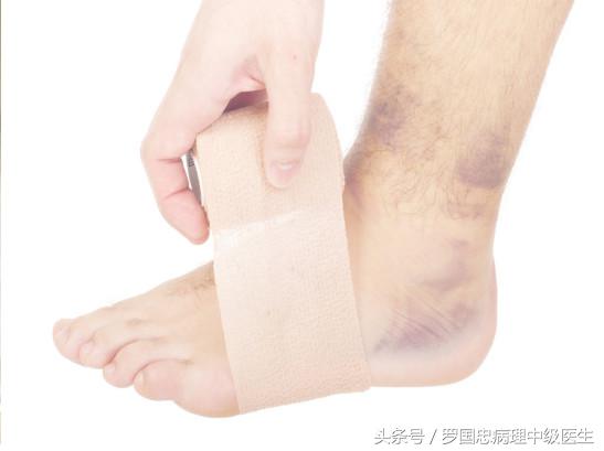 舒筋活络膏骨折可以用嘛,舒筋活络膏骨折