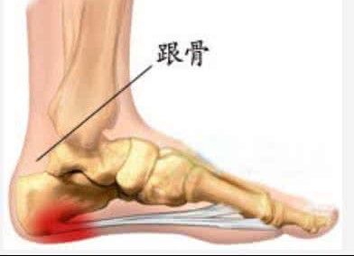 防止足跟长骨刺的鞋,脚后跟有骨刺要购买什么鞋