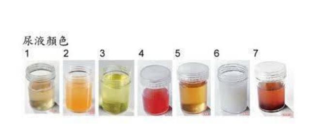 糖尿病测血糖可以用馒头代替吗,糖尿病可不可以用试纸测试