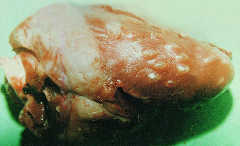 人感染猪囊虫病怎么办,人畜共患寄生虫病中的动物是什么