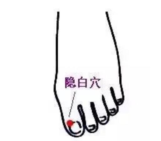 湿气重拔罐多久祛除湿气,湿气重拔罐能解决湿气吗