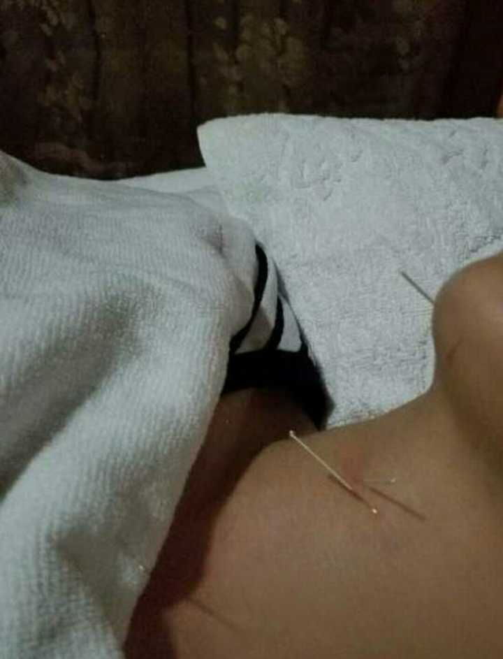 大幂幂干活不要命,生病以至要接受放血治疗,但又被媒体黑是什么梗,网友直逼媒体道歉