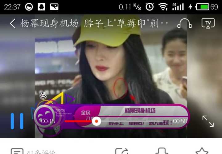 大幂幂干活不要命,生病以至要接受放血治疗,但又被媒体黑是什么梗,网友直逼媒体道歉