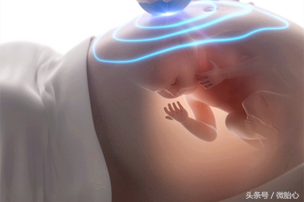 提醒哪些孕妈容易早产如何预防,最容易引起早产的因素是