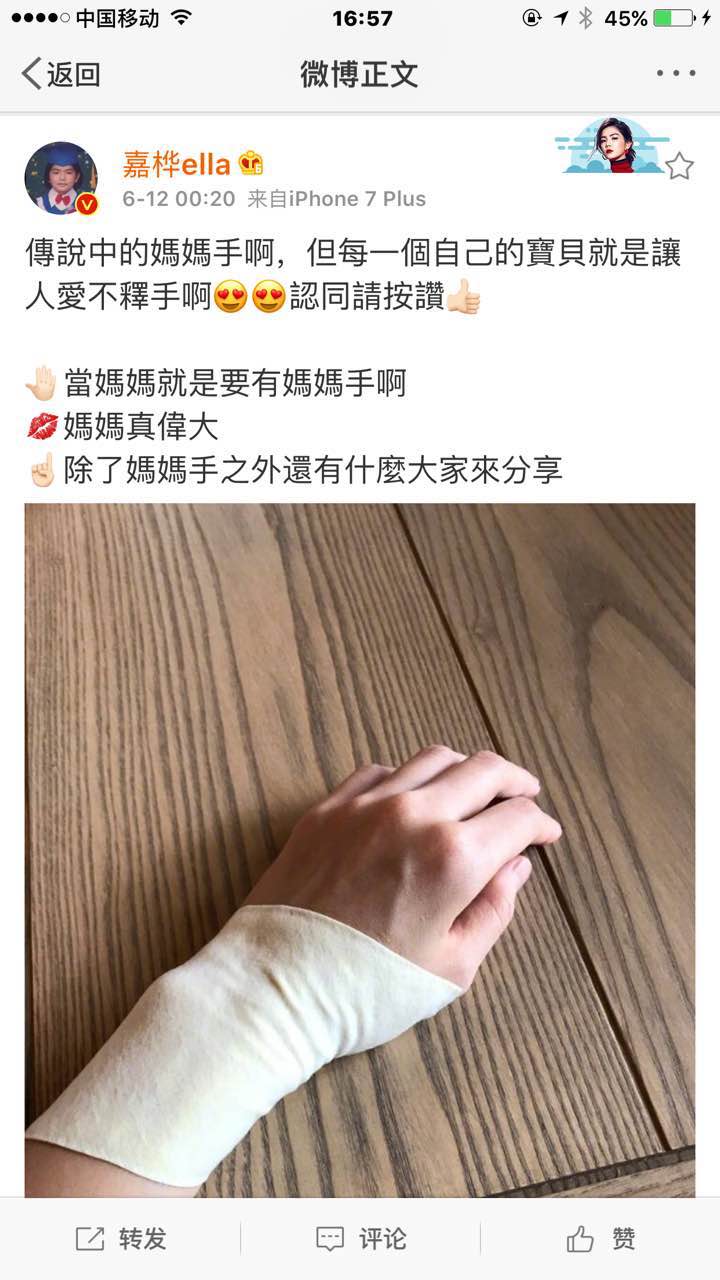 明星Ella说一抱宝宝手就疼，原来是患上了传说中“妈妈手”-手腕腱鞘炎，该怎么办？