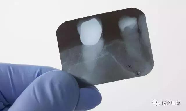 孕妇牙疼怎么办?忍着还是看牙医?