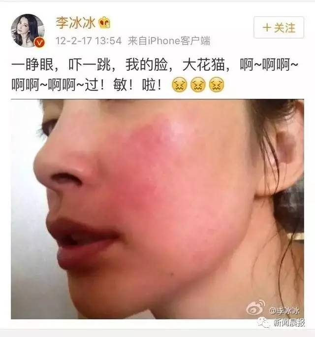 明星都逃不掉的事,健康Q博士说不定有办法