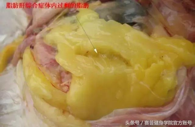 脂肪的知识跟吃有关,脂肪燃烧的知识